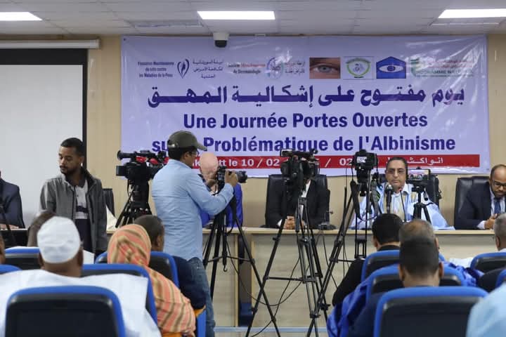 هيئات مدنية تنظم يوما علميا لصالح مرضى المهق بنواكشوط
